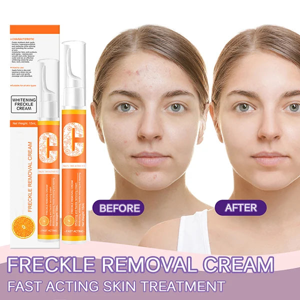 Vitamin C Freckle Dark Spot Removal Cream
